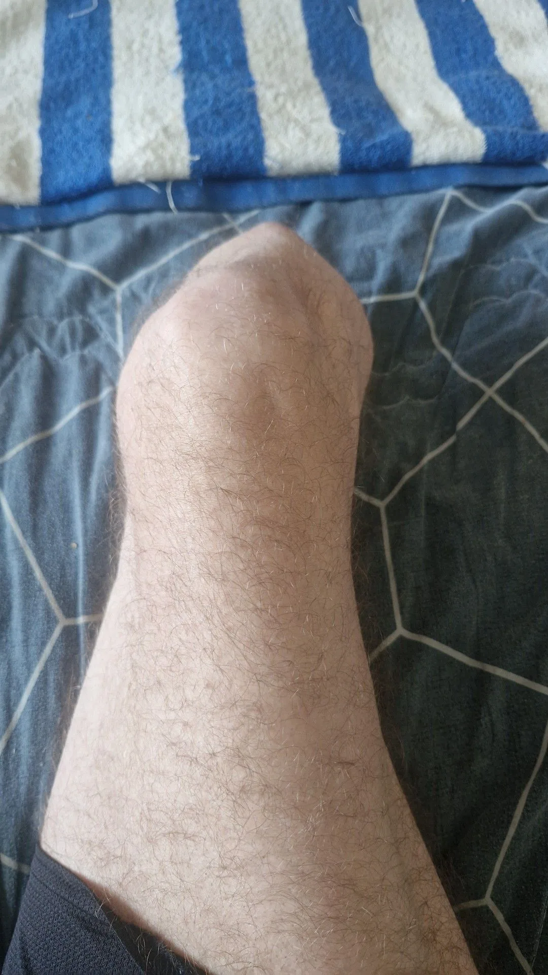 2형 당뇨 있으신 분들, 맞는 건강보험 어디서 드셨어요?